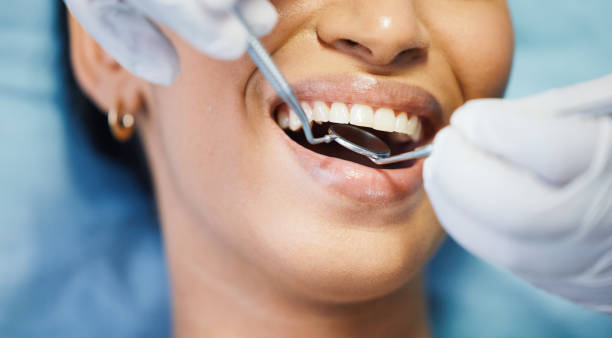 Best Weekend Emergency Dental Services in Ransom Canyon, TX