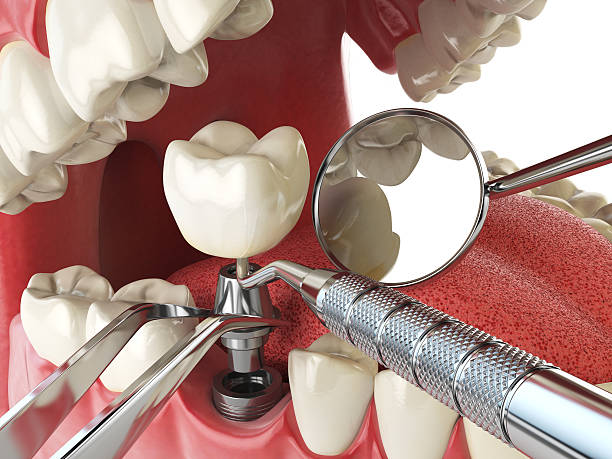 Best Walk-In Emergency Dental Services in Ransom Canyon, TX